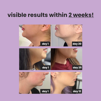 4-in-1 facial sculpting device